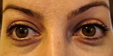 Image of LuxeBiotics™ Dark Circle & Puffiness Under-Eye Serum