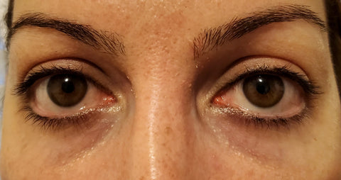 Image of LuxeBiotics™ Dark Circle & Puffiness Under-Eye Serum