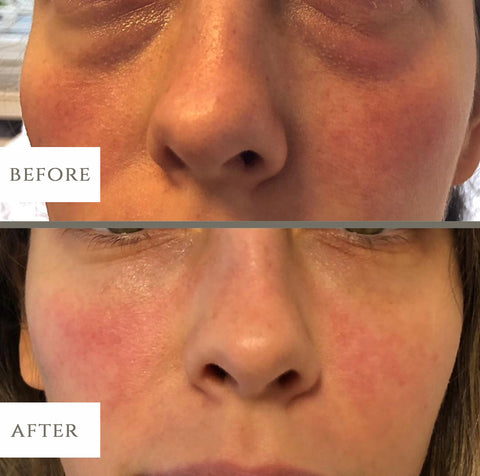 Image of LuxeBiotics™ Dark Circle & Puffiness Under-Eye Serum
