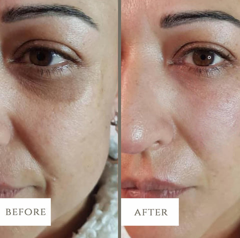 Image of LuxeBiotics™ Dark Circle & Puffiness Under-Eye Serum
